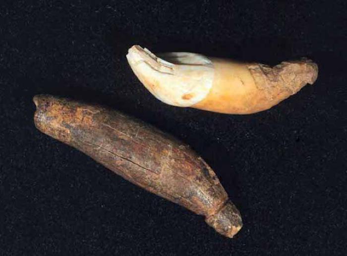 Tooth