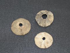 Vertebra